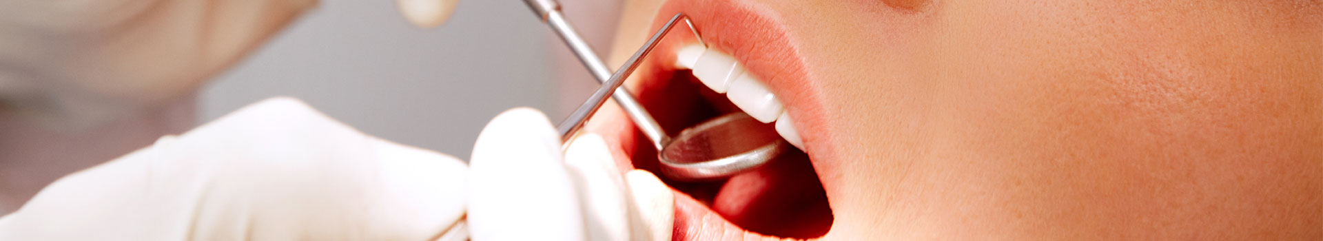 墨尔本的牙科检查和清洁