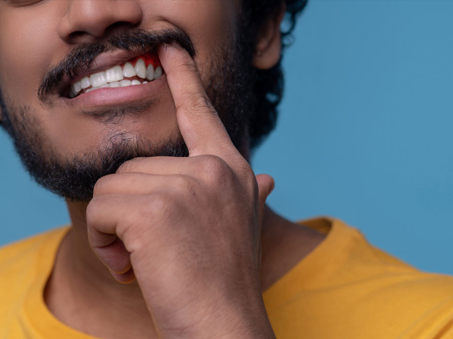 墨尔本智齿疼痛