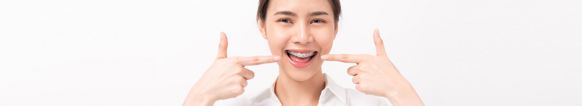 MC Dental 墨尔本矫正牙齿 传统矫正器