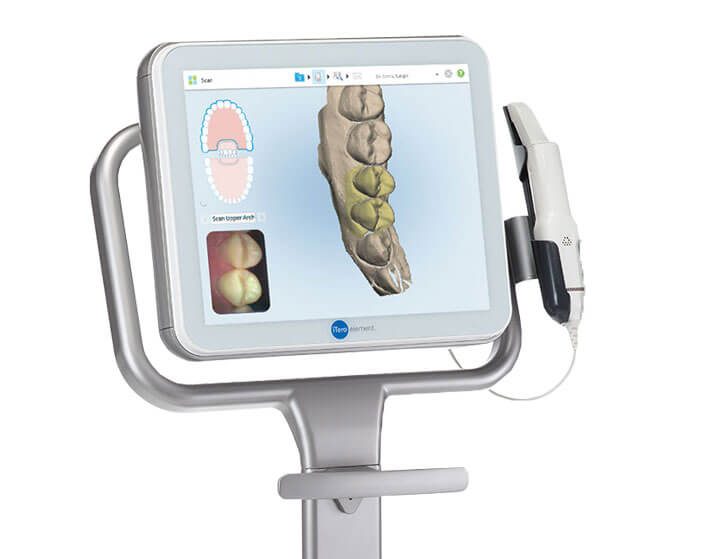 itero scanner ITero 扫描