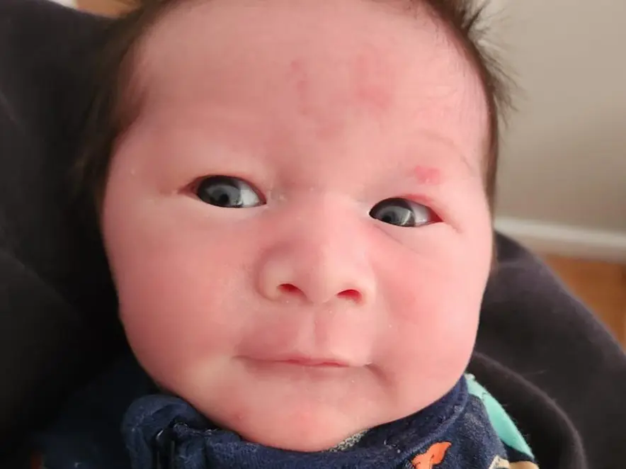 在我们牙医诊所经历了妈妈羊水破的婴儿